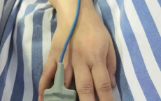 美甲成悲剧：女子心跳骤停，美甲阻碍抢救